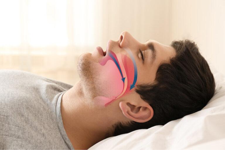 8 Ways to Stop Mouth Breathing When Sleeping [Nurses Diaries] Educative News Room